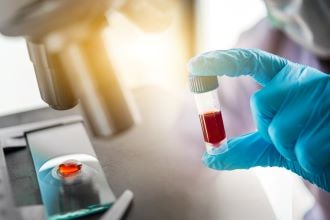 Blood test